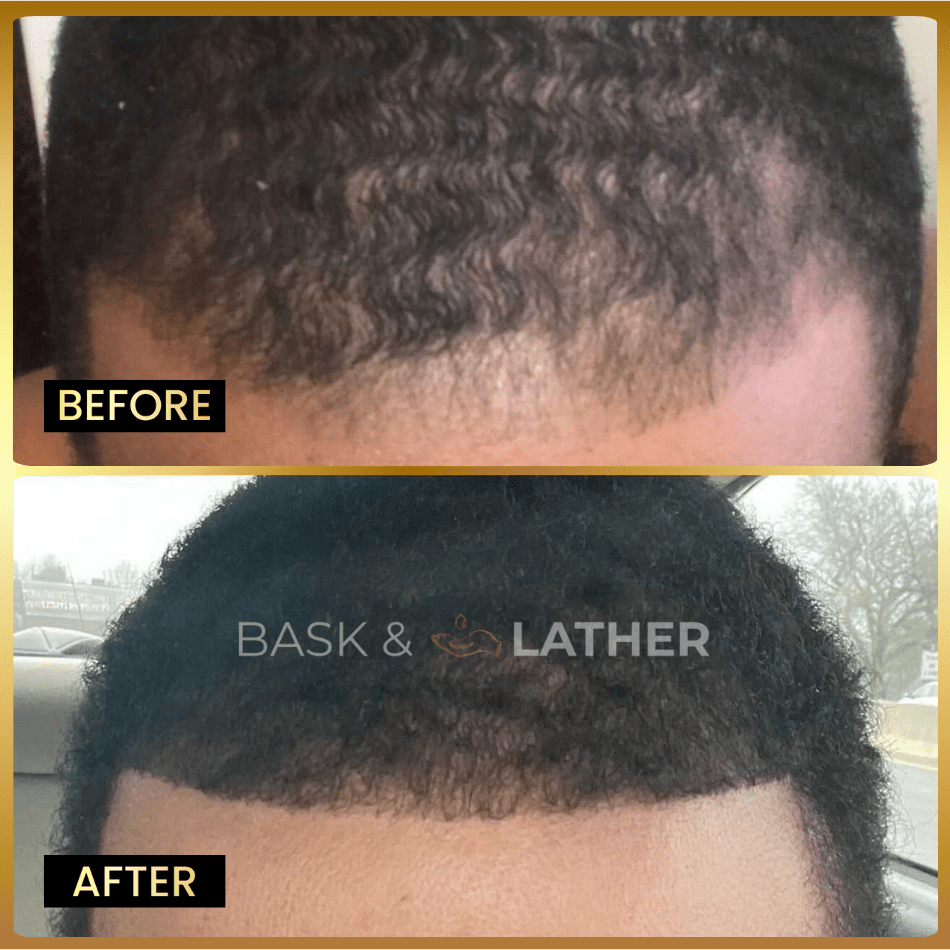 Men's Beard & Hair Growth Bundle - Image 3