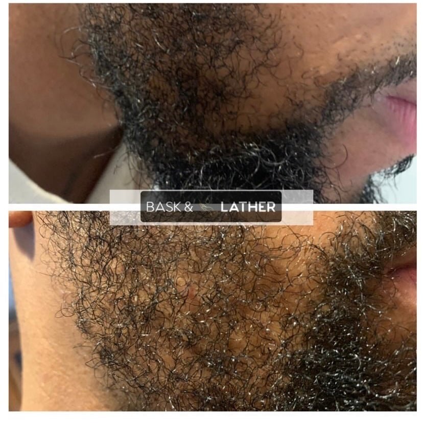 Men's Beard & Hair Growth Bundle - Image 2